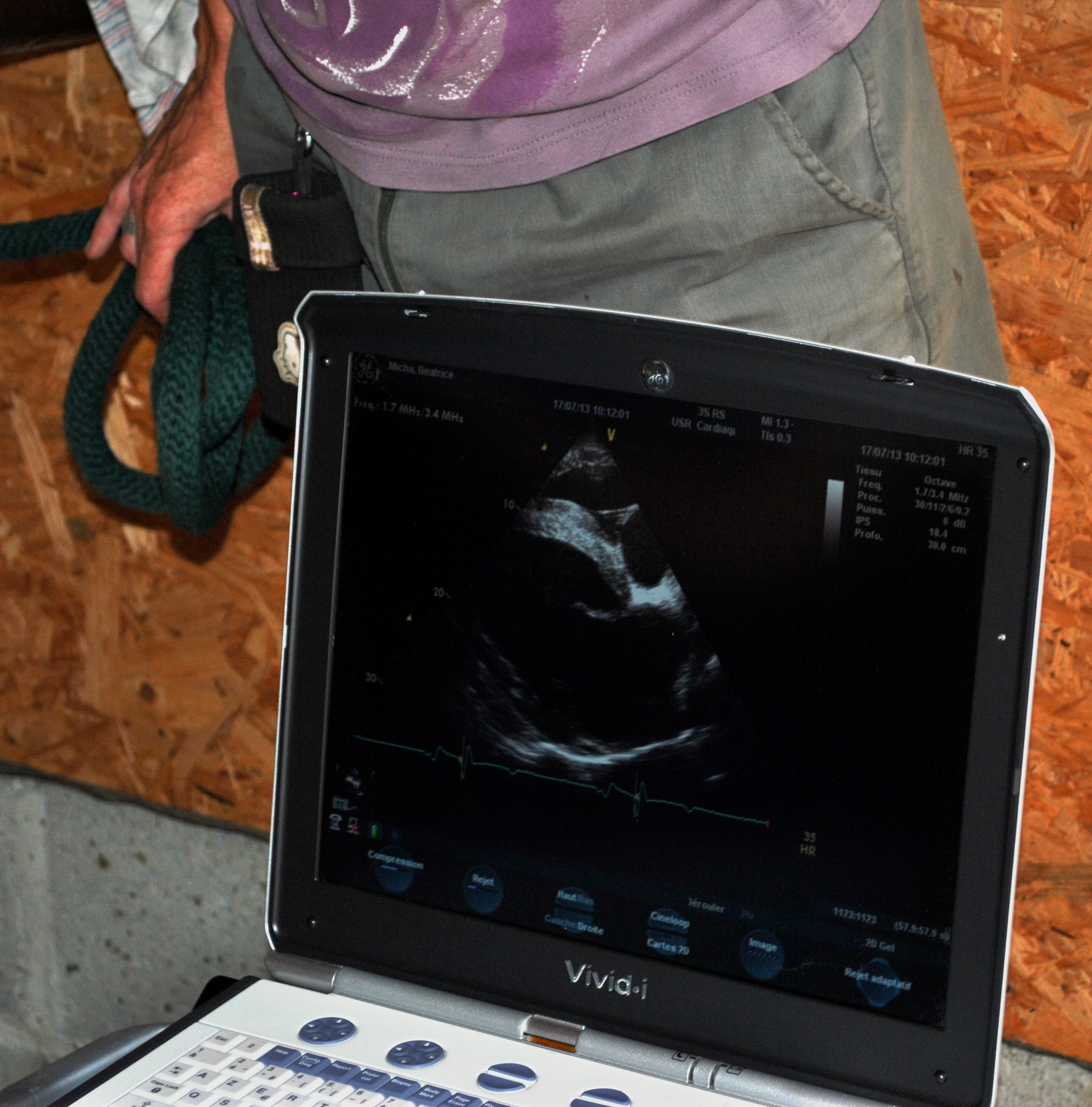 Échocardiographie