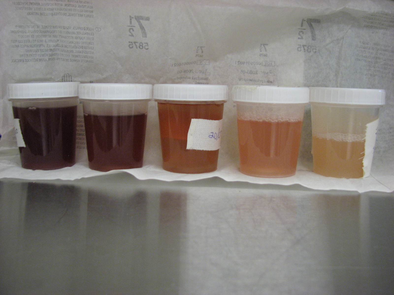 Myoglobinurie