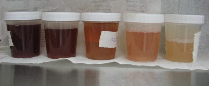Modification de la couleur des urines d'un cheval atteint de myopathie à cause de présence de pigments (myoglobine).