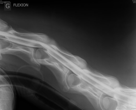 Radiographie avec produit de contraste de l'encolure d'un cheval souffrant d'un mal-alignement entre la vertèbre C3 et C4 (syndrome de Wobbler).